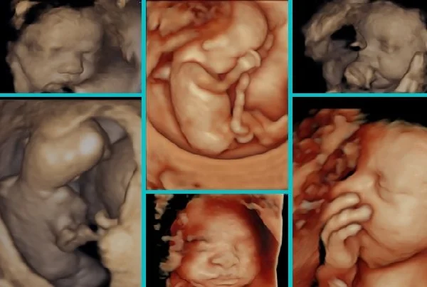 3D and 4D Ultrasound