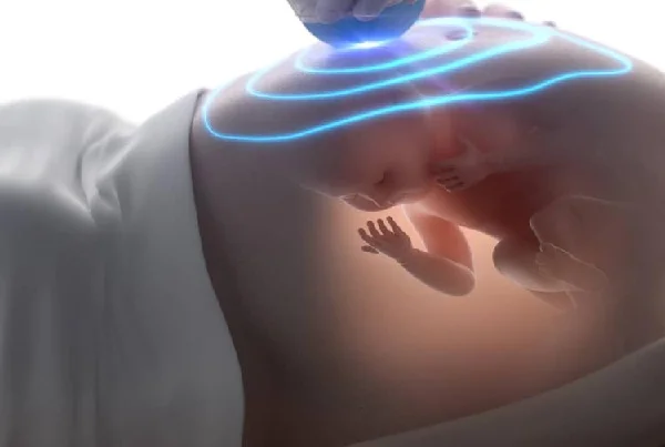 Level II Ultrasound