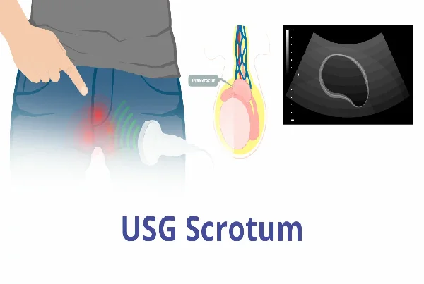 Scrotum USG