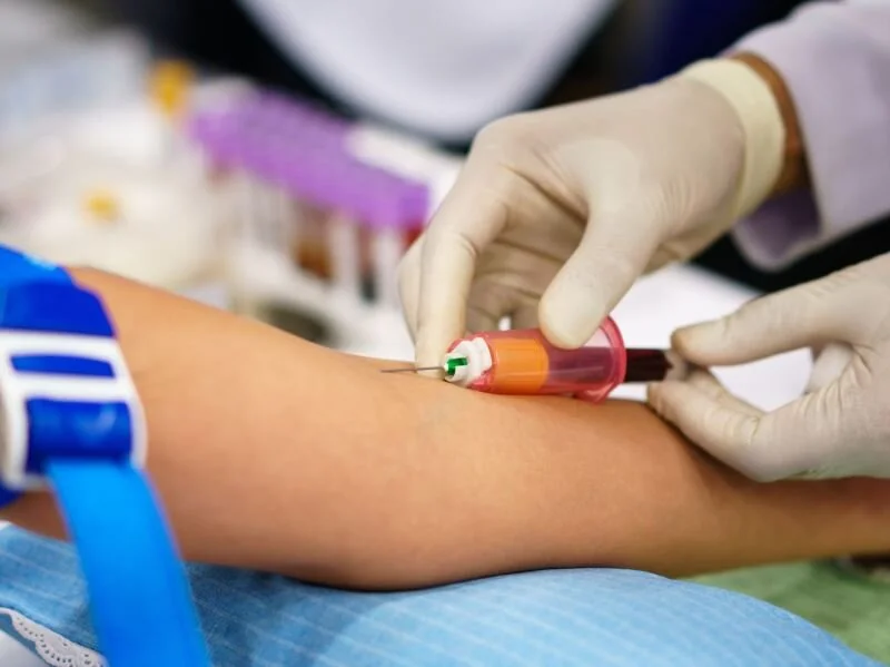 Blood Test